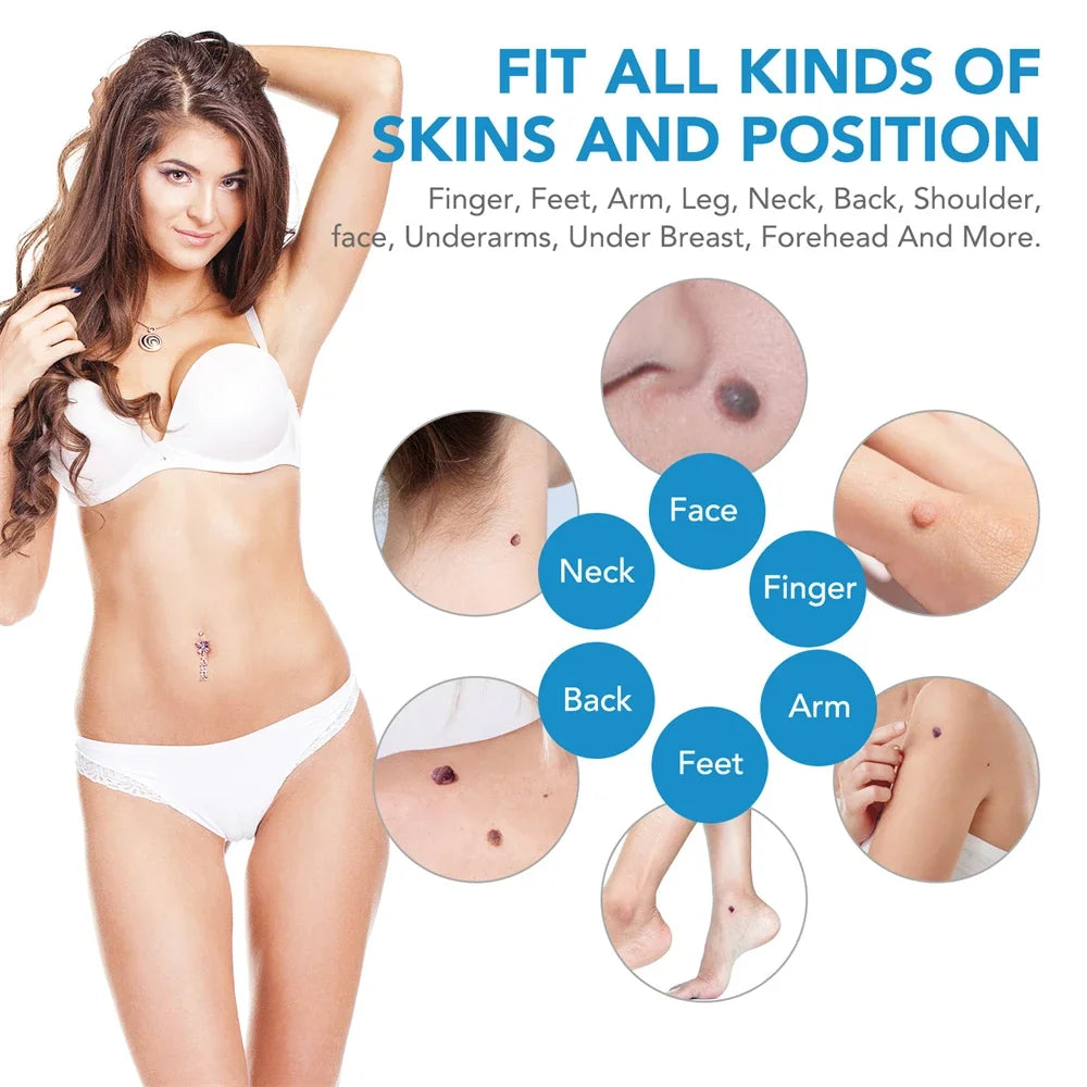 2 IN 1 Auto Micro Skin Tag Remover Device Skin Tag Removal Kit