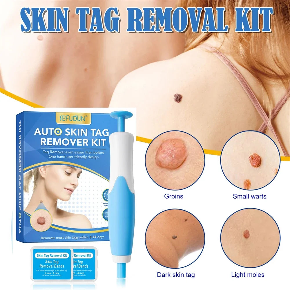2 IN 1 Auto Micro Skin Tag Remover Device Skin Tag Removal Kit