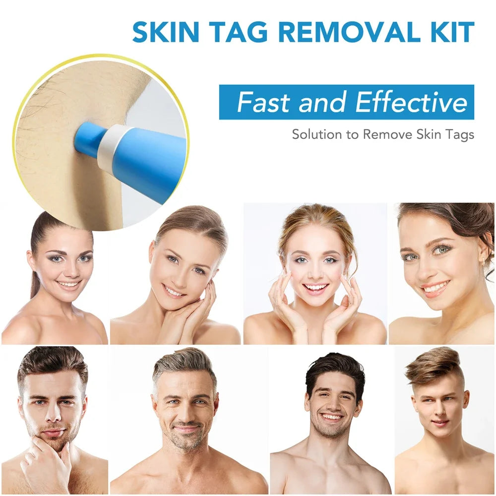 2 IN 1 Auto Micro Skin Tag Remover Device Skin Tag Removal Kit