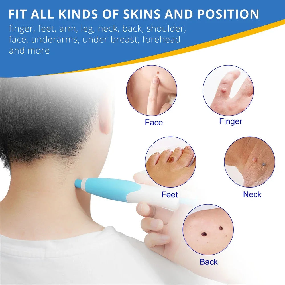 2 IN 1 Auto Micro Skin Tag Remover Device Skin Tag Removal Kit