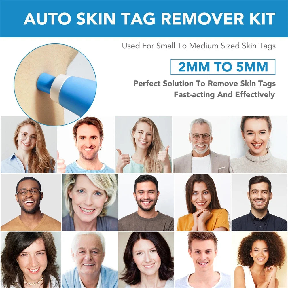 2 IN 1 Auto Micro Skin Tag Remover Device Skin Tag Removal Kit